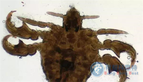 殺蟲公司帶你生活中十五種寄生蟲