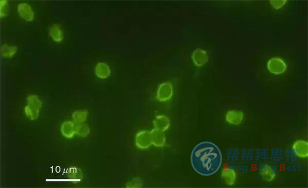 殺蟲公司帶你生活中十五種寄生蟲