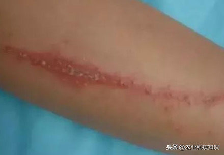 這蟲子可是個狠角色，惹不起，躲著走