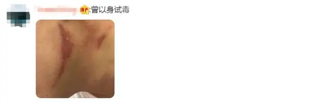 別再關燈玩手機了！這種蟲會毀容！切記不要拍......