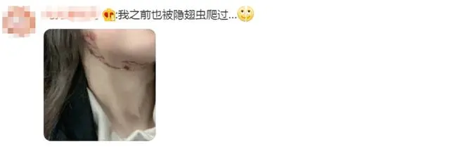 別再關燈玩手機了！這種蟲會毀容！切記不要拍......